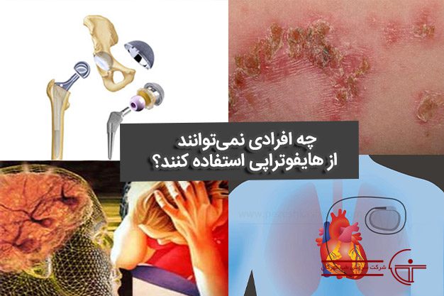 چه افرادی نمی‌توانند از هایفوتراپی استفاده کنند؟