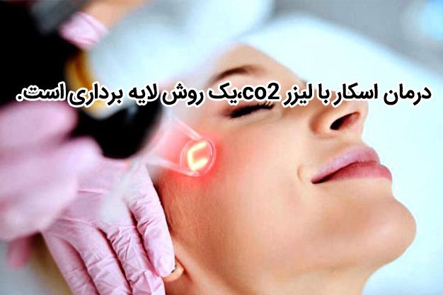 درمان اسکار با لیزر co2،یک روش لایه برداری است.