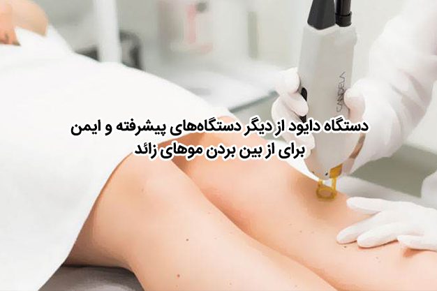 دستگاه دایود از دیگر دستگاه‌های پیشرفته و ایمن برای از بین بردن موهای زائد